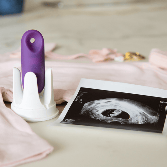 Der lila trackleCatch steht in seiner weißen Halterung auf einem hellrosafarbenen Kleidungsstück. Rechts daneben liegt ein ausgedrucktes Schwarz-Weiß-Ultraschallbild einer frühen Schwangerschaft. Im unscharfen Hintergrund sind weitere Baby-Accessoires und ein Schnuller zu erkennen. Die Szene symbolisiert den Erfolg der Kinderwunsch-Reise mit trackle.